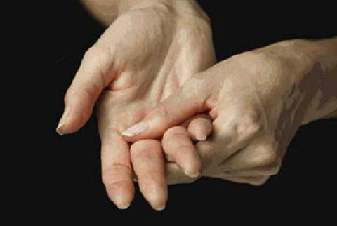 Đau tay, ngón tay kèm tổn thương mắt là triệu chứng ung thư phổi cần chú ý