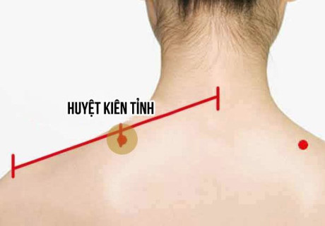 Xoa bóp bấm huyệt trị viêm quanh khớp vai - Ảnh 1 Xoa bop bam huyet tri viem quanh khop vai - Anh 1