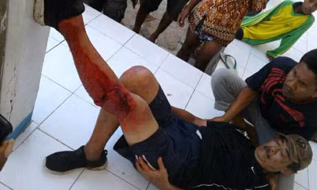 Ham chup anh, du khach bi rong Komodo tan cong - Anh 2