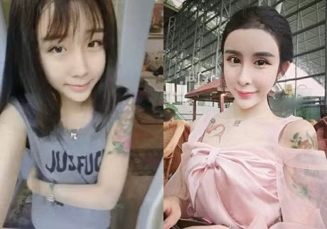 Soc voi nhung ca phau thuat hong, muon hoi han cung khong con co hoi - Anh 7