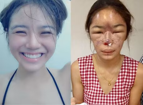 Soc voi nhung ca phau thuat hong, muon hoi han cung khong con co hoi - Anh 4