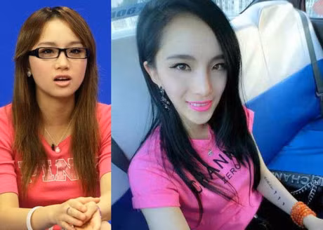 Soc voi nhung ca phau thuat hong, muon hoi han cung khong con co hoi - Anh 5