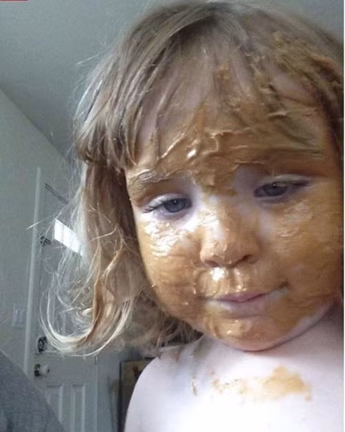 cuoi te ghe voi nhung tai nan son phan do be yeu gay ra - 7