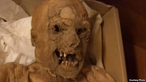 Xác ướp từ thế kỉ 18: Tiết lộ nguyên nhân mắc ung thư trực tràng