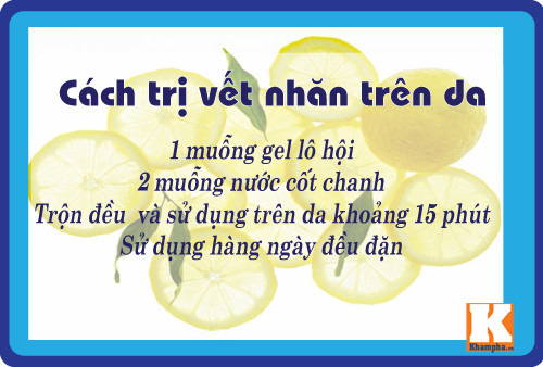 8 cach tri da nhan nheo don gian ma hieu qua tu lo hoi - 2