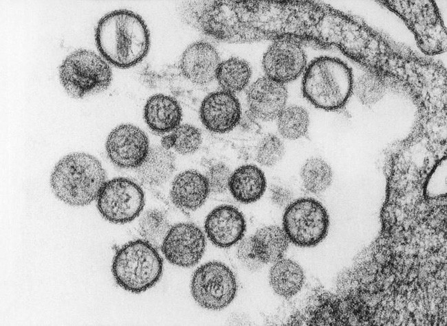 Những loại virus gây chết người kinh khủng nhất mọi thời đại - Ảnh 8. Những loại virus gây chết người kinh khủng nhất mọi thời đại - Ảnh 8.