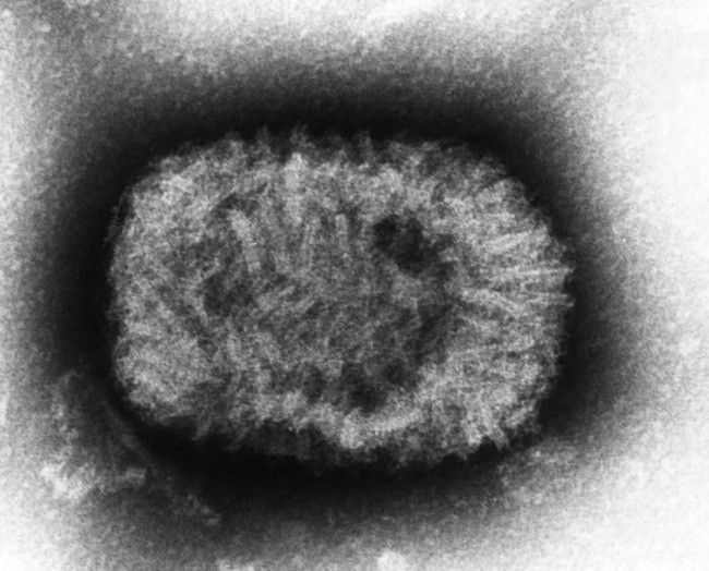 Những loại virus gây chết người kinh khủng nhất mọi thời đại - Ảnh 6. Những loại virus gây chết người kinh khủng nhất mọi thời đại - Ảnh 6.