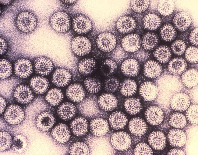Những loại virus gây chết người kinh khủng nhất mọi thời đại - Ảnh 11. Những loại virus gây chết người kinh khủng nhất mọi thời đại - Ảnh 11.