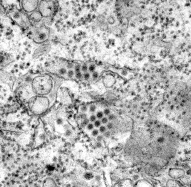 Những loại virus gây chết người kinh khủng nhất mọi thời đại - Ảnh 10. Những loại virus gây chết người kinh khủng nhất mọi thời đại - Ảnh 10.