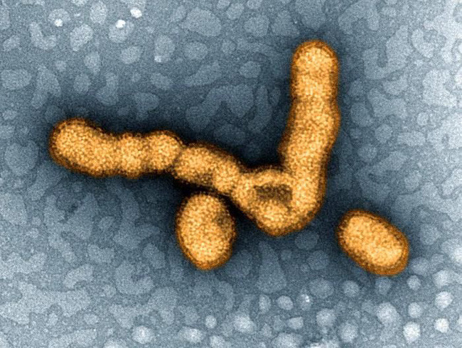 Những loại virus gây chết người kinh khủng nhất mọi thời đại - Ảnh 9. Những loại virus gây chết người kinh khủng nhất mọi thời đại - Ảnh 9.