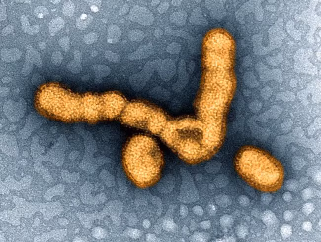 Những loại virus gây chết người kinh khủng nhất mọi thời đại - Ảnh 9.