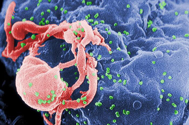 Những loại virus gây chết người kinh khủng nhất mọi thời đại - Ảnh 5. Những loại virus gây chết người kinh khủng nhất mọi thời đại - Ảnh 5.