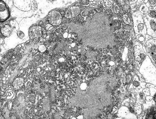 Những loại virus gây chết người kinh khủng nhất mọi thời đại - Ảnh 4. Những loại virus gây chết người kinh khủng nhất mọi thời đại - Ảnh 4.
