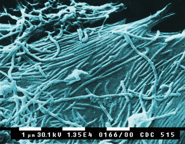 Những loại virus gây chết người kinh khủng nhất mọi thời đại - Ảnh 3. Những loại virus gây chết người kinh khủng nhất mọi thời đại - Ảnh 3.