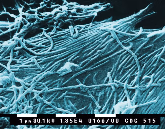 Những loại virus gây chết người kinh khủng nhất mọi thời đại - Ảnh 3.