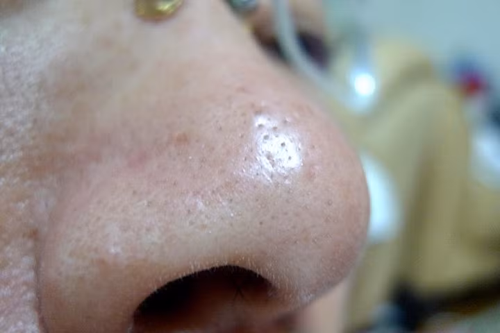 Sai lầm khi làm đẹp bạn tuyệt đối không được mắc phải