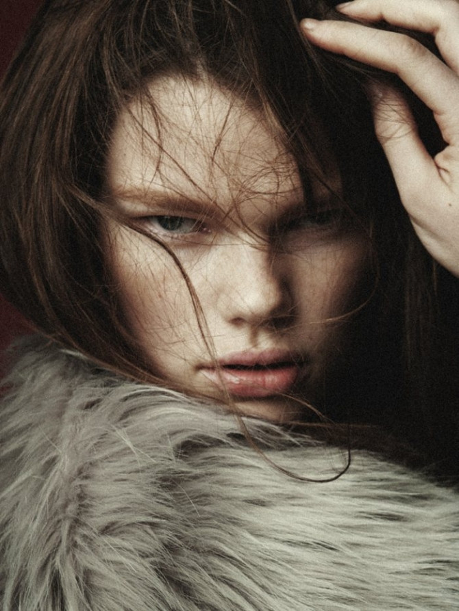 Người mẫu bạch tạng, răng hô nổi tiếng, kiếm bộn tiền - Ảnh 1