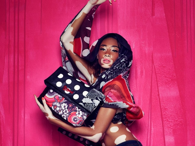 Người mẫu bạch tạng, răng hô nổi tiếng, kiếm bộn tiền - Ảnh 10