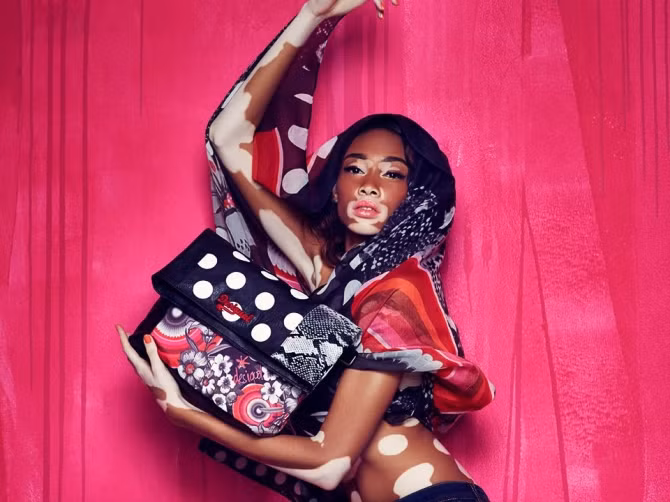 Người mẫu bạch tạng, răng hô nổi tiếng, kiếm bộn tiền - Ảnh 10