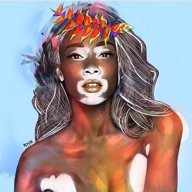 Người mẫu bạch tạng, răng hô nổi tiếng, kiếm bộn tiền - Ảnh 9