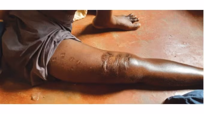 Người đàn ông cùng lúc chiến đấu tay không với ít nhất 3 con cá sấu hung tợn đã bị thương nặng.