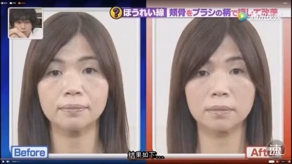 Học chuyên gia Nhật "đánh bay" nếp nhăn khóe miệng chỉ sau 1 phút ảnh 7