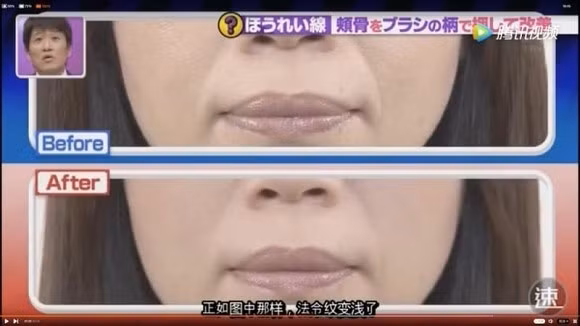 Học chuyên gia Nhật "đánh bay" nếp nhăn khóe miệng chỉ sau 1 phút ảnh 9