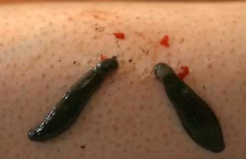 Rùng mình những sinh vật ký sinh hút máu ảnh 4