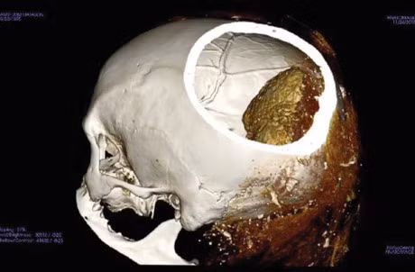 Them nhieu phat hien moi ve xac uop lien quan den y hoc - Anh 5