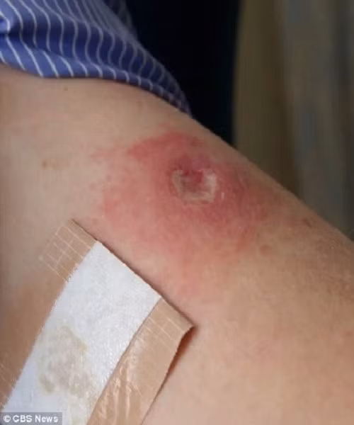 thanh pho that lac 500 nam chua ky sinh trung an mat nguoi hinh anh 6