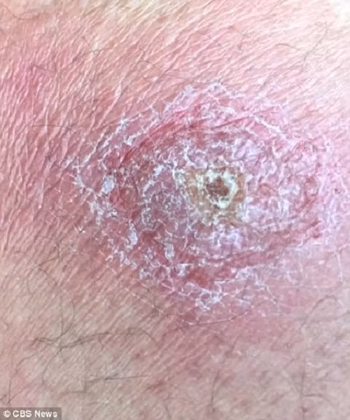 thanh pho that lac 500 nam chua ky sinh trung an mat nguoi hinh anh 7