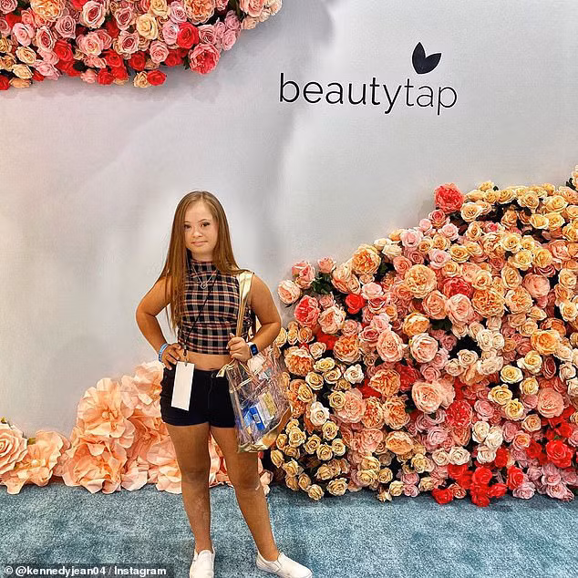 Bé gái mắc hội chứng Down khiến bác sĩ lắc đầu khuyên gia đình gửi vào trại trẻ để tránh gánh nặng, 15 năm sau ai cũng ngạc nhiên khi nhìn thấy cô bé ấy - Ảnh 10.