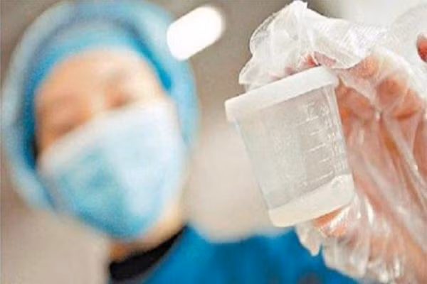 Việc cho - nhận tinh trùng được thực hiện như thế nào?