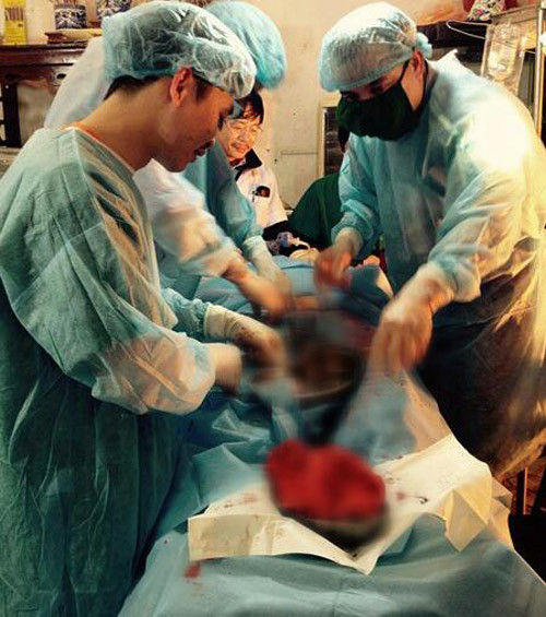 cong bo hinh anh ca mo hi huu cuu song san phu ngay tai nha - 3