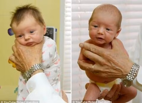 Bac si bat mi cach ky dieu lam tre nin khoc