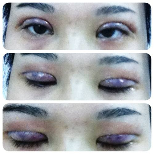 cắt mí, thẩm mĩ, chị em, đổ xô, chơi tết, làm đẹp cắt mí, thẩm mĩ, chị em, đổ xô, chơi tết, làm đẹp