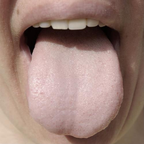 Tưởng mắc bệnh nan y hóa ra đây chỉ là những dấu hiệu cảnh báo thiếu Vitamin B12 ảnh 5