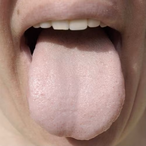 Tưởng mắc bệnh nan y hóa ra đây chỉ là những dấu hiệu cảnh báo thiếu Vitamin B12 ảnh 5