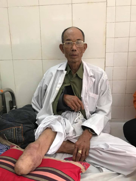 Thương binh bị đánh trọng thương đề nghị khởi tố các đối tượng - Ảnh 1 Thuong binh bi danh trong thuong de nghi khoi to cac doi tuong - Anh 1