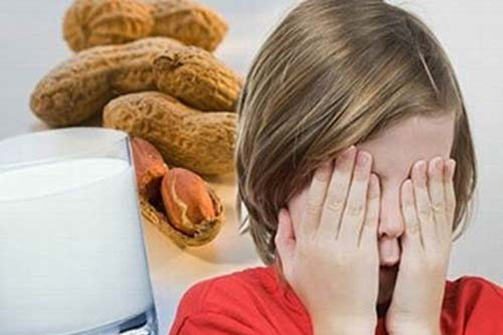 Làm gì khi dị ứng thực phẩm?
