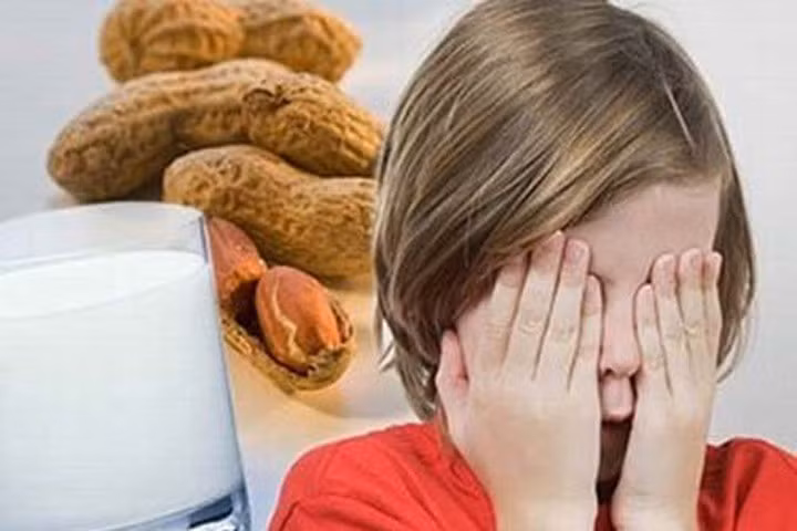 Làm gì khi dị ứng thực phẩm?