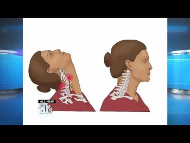 Sau một lần gội đầu ngoài tiệm, người đàn ông hóa tàn phế ảnh 1