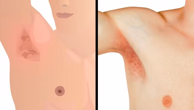 Biết những hậu quả “rợn người” này, ai còn lười tắm nhất định phải bỏ ngay lập tức - 3