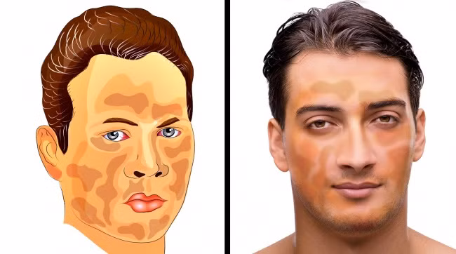 Biết những hậu quả “rợn người” này, ai còn lười tắm nhất định phải bỏ ngay lập tức - 8