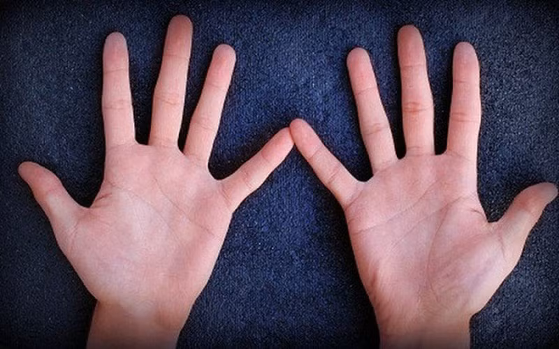 Bàn tay có nhiều vân thẳng cho thấy cuộc sống phía trước của bạn cũng không gặp nhiều may mắn - Ảnh: Minh họa