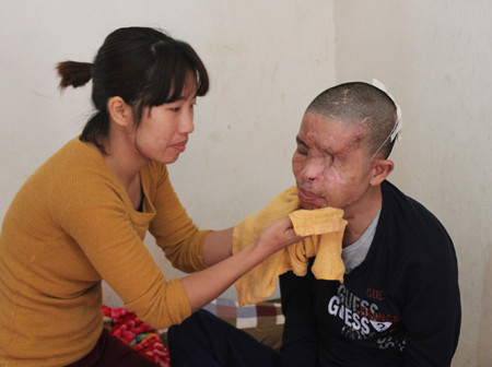 Cảnh “sống không bằng chết” của nạn nhân sau vụ gài mìn gửi qua xe khách ảnh 3 Mọi sinh hoạt cá nhân, tù việc nhỏ nhất đều phải nhờ vào vợ.