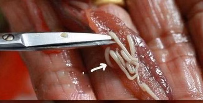 Top 5 món ăn chứa nhiều con “ngoe nguẩy” bạn nên coi trước khi ăn