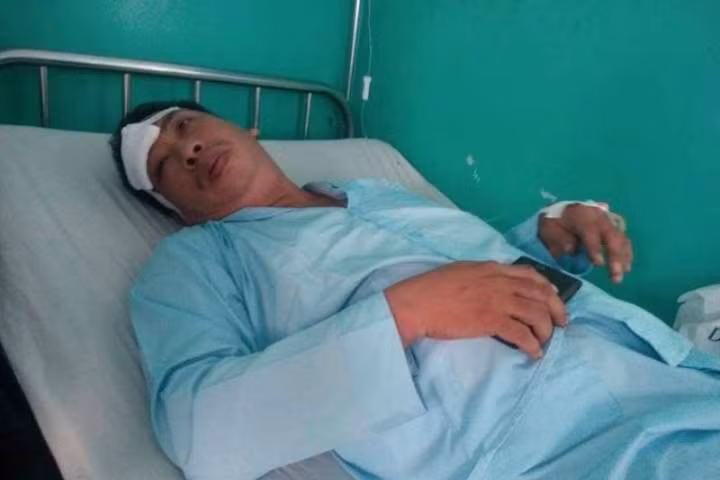 Nạn nhân Vĩnh đang điều trị tại bệnh viện