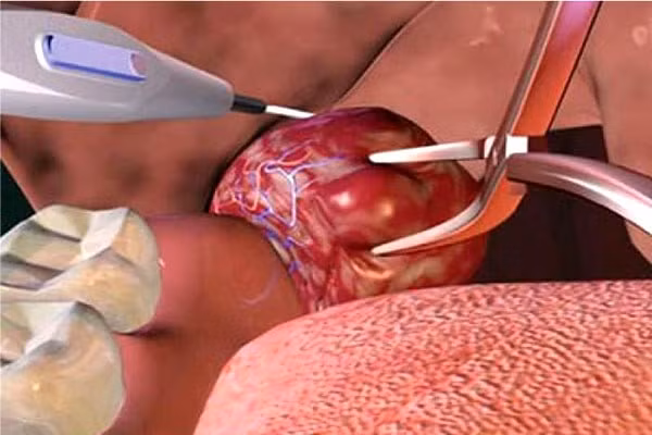 Bé gái 7 tuổi tử vong chỉ sau vài phút phẫu thuật cắt amidan, chuyên gia đưa ra một loạt cảnh báo-4