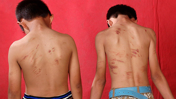 Bắt 7 đối tượng “cướp máu” trẻ em ảnh 1 Bắt 7 đối tượng “cướp máu” trẻ em ảnh 1